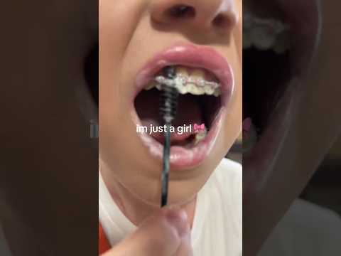 Using A Mascara Brush On Your Braces ISN'T A Crazy Idea! 😅🦷