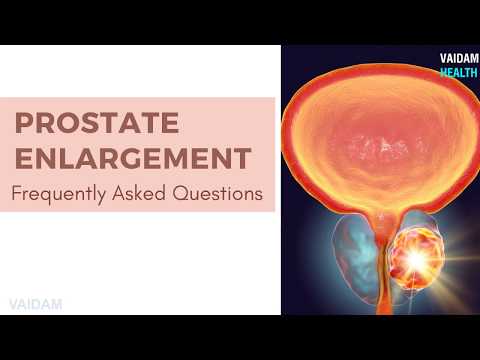 Prostate Enlargement- Frequently Asked Questions
