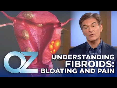 Are Your Fibroids Making You Bloated and Painful? Here's What You Need to Know | Oz Health