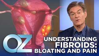 Are Your Fibroids Making You Bloated and Painful? Here