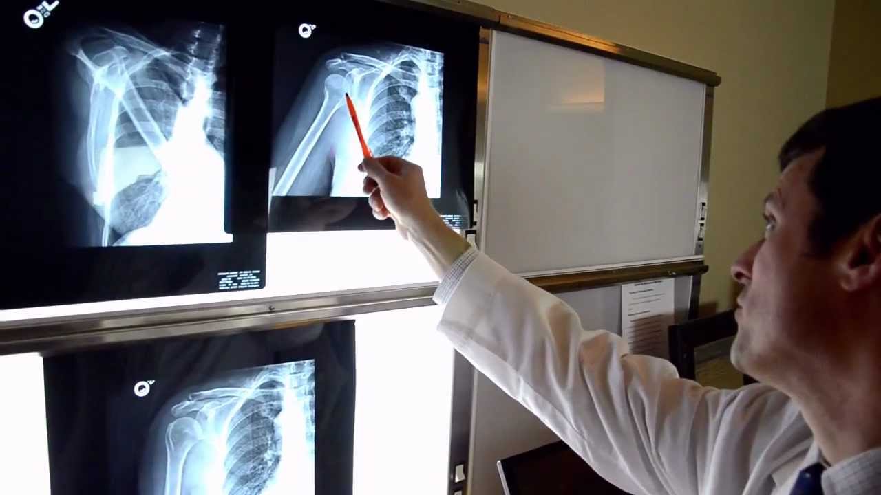 Information Video - Advanced Bone & Joint