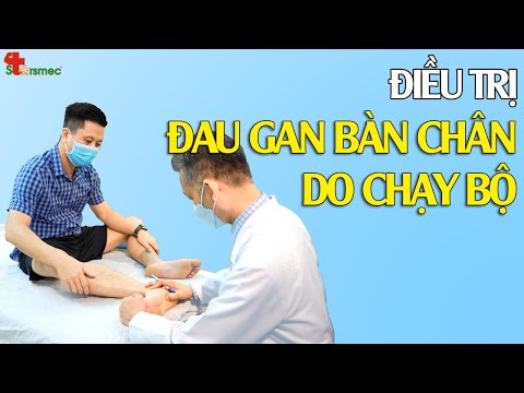 Đau gan bàn chân do chạy bộ - Điều trị và chăm sóc thế nào?