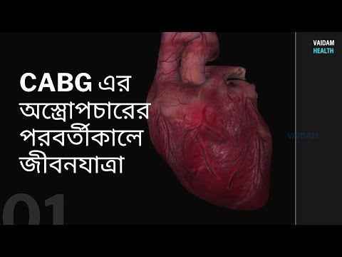 CABG অস্ত্রোপচারের পরবর্তী জীবন