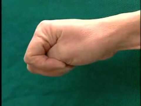 La terapia esercizio di osteocondrosi interscapolare Che fa male il lato sinistro della schiena