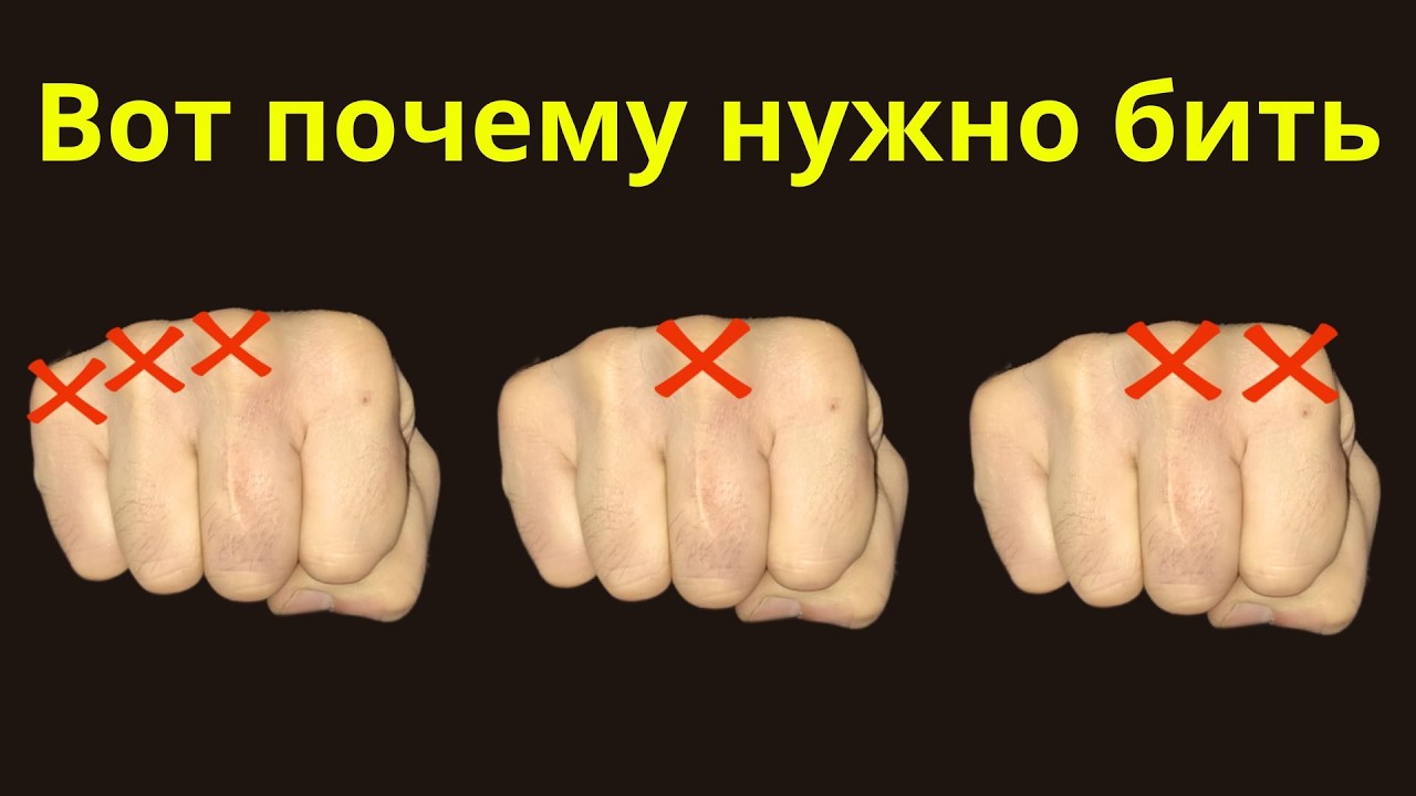 Уронишь на Ж*ПУ любого