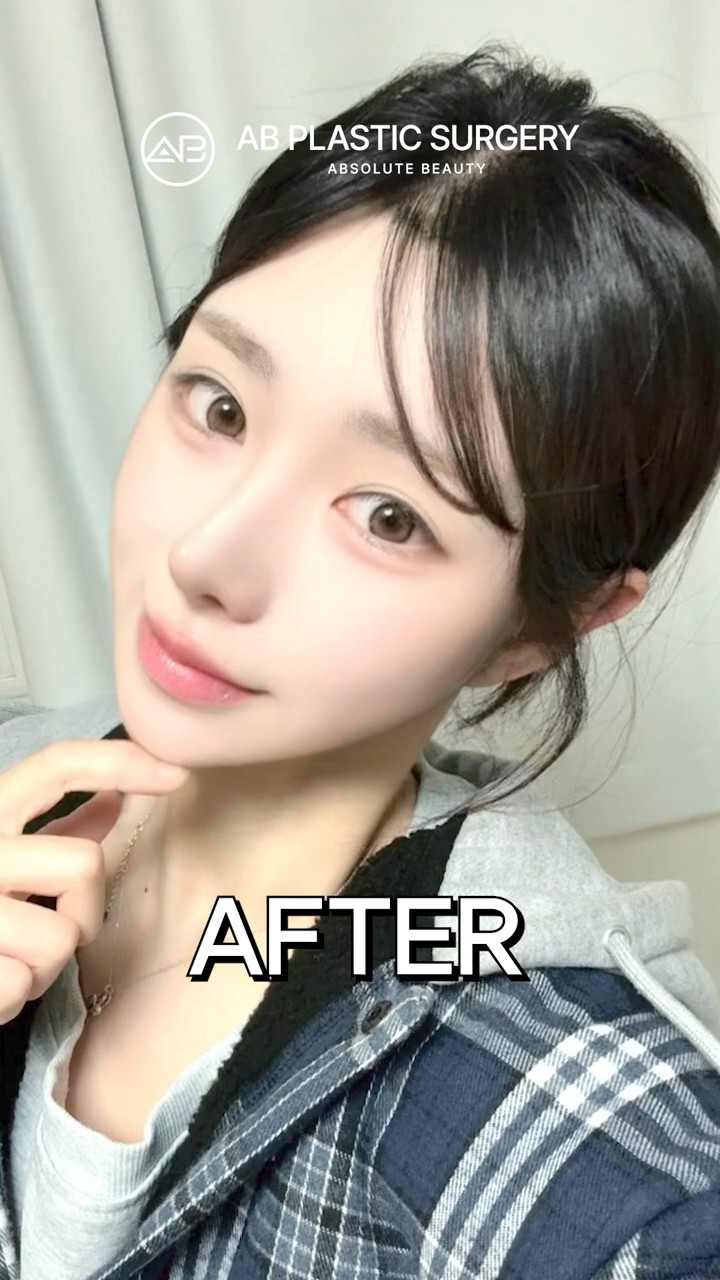 Her Face Shape Completely Changed After Facial Contouring
