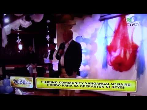 Ano ay babol gam para sa pagbaba ng timbang Maaari kang mawalan ng timbang sa isang diyeta ng kanin gulay manok 9 na araw