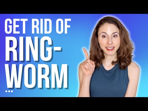 HOW TO GET RID OF RINGWORM 🤔 TIPS FROM A DERMATOLOGIST @DrDrayzday