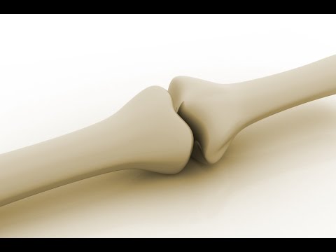 Osteoporosis Is Not a Calcium Deficiency!  Take This Instead