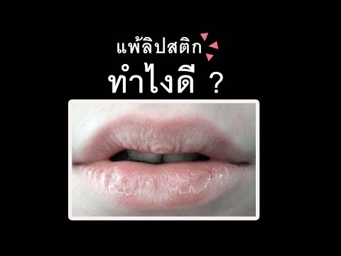 การทดสอบในปรัชญาอากลาก พืชชนิดหนึ่งทิงเจอร์ของโรคสะเก็ดเงิน