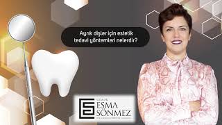 Dr. Esma Sönmez noted the esthetic treatment options for the teeth with diastema.