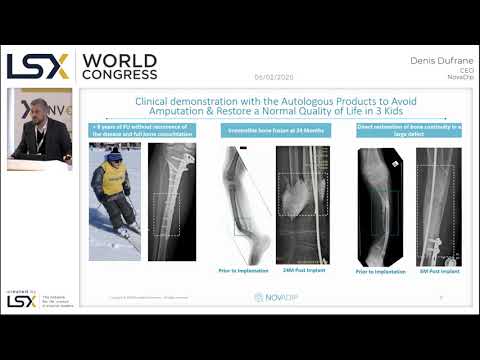 LSX World Congress 2020 Presentations - NovaDip