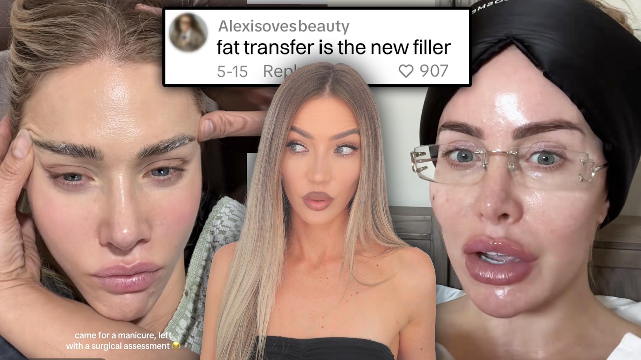 fat transfer is the new fillers