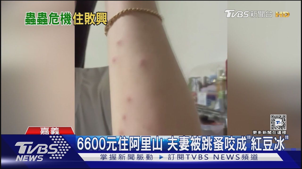 6600元住一晚阿里山民宿!夫妻被跳蚤咬成「紅豆冰」