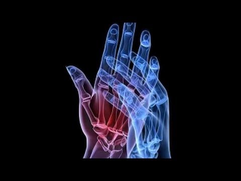 Cum să elimini durerea în articulația degetului mare