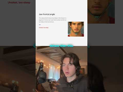 What the Jaw Frontal Angle Reveals About Midface Harmony