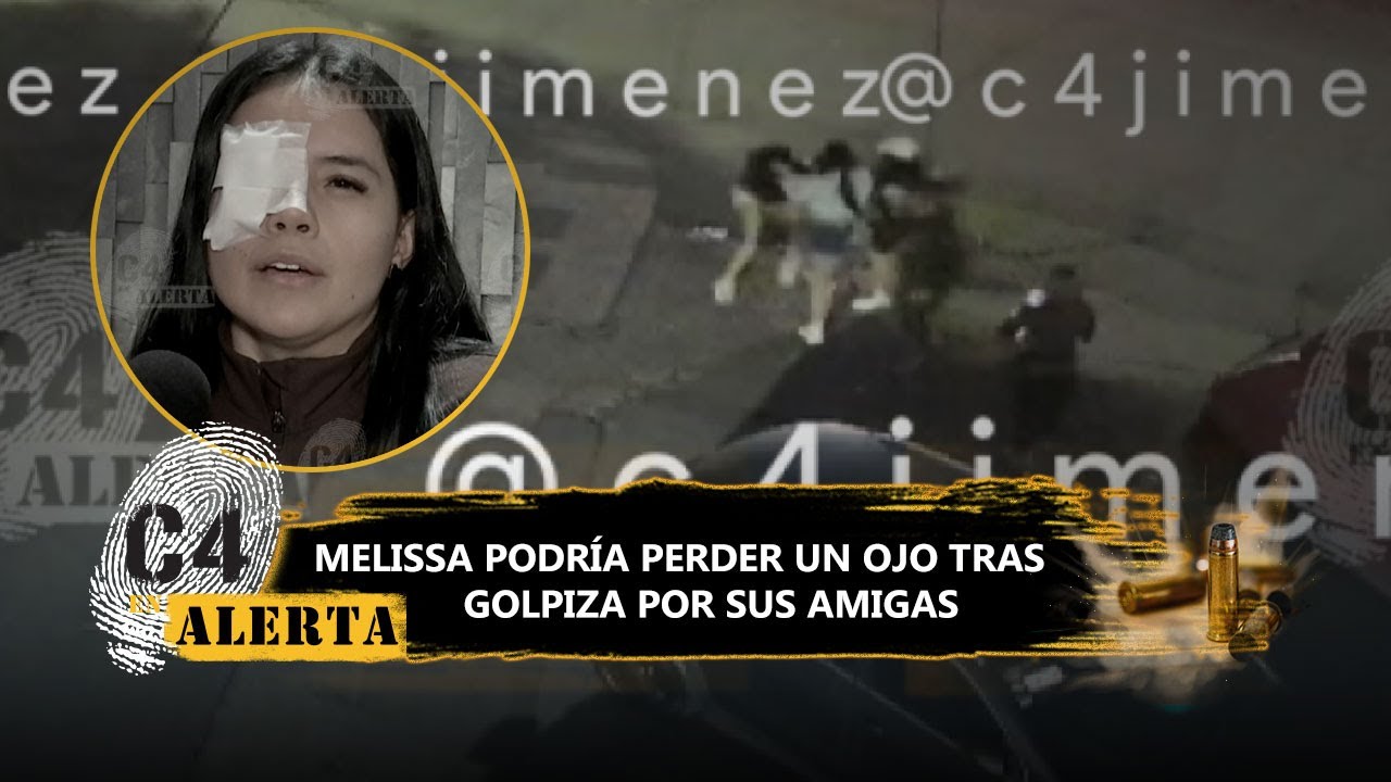 Amigas de Melissa agreden afuera de un gimnasio en Nezahualcóyotl; está en riesgo de perder un ojo