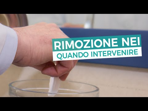 Forte dolore nella parte bassa della zona lombare Esercizi per alleviare il dolore durante lernia intervertebrale