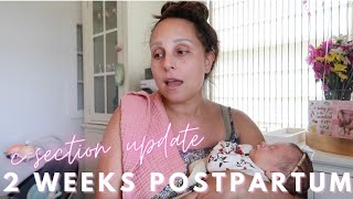 2 WEEK POSTPARTUM UPDATE | healing from a repeat c-section 👎🏻