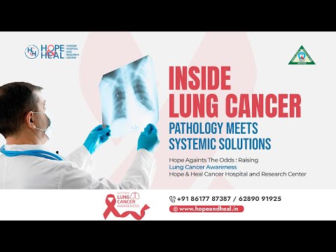 Lung Cancer Diagnosis & Treatments | Dr. Saptarshi Ghosh & Dr. Shreyasee Sarkar