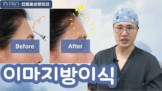 필러랑 지방이식 중에 뭐가 더 좋아요?