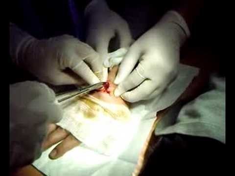 Ejercicios para el desarrollo de tobillo Corea articulaciones artificiales