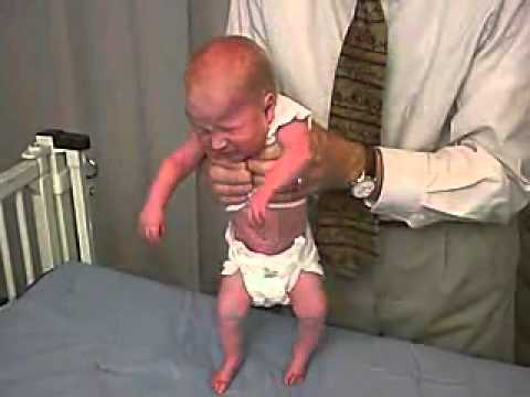 12/23. Clinical Pediatrics:  Hypotonia 6