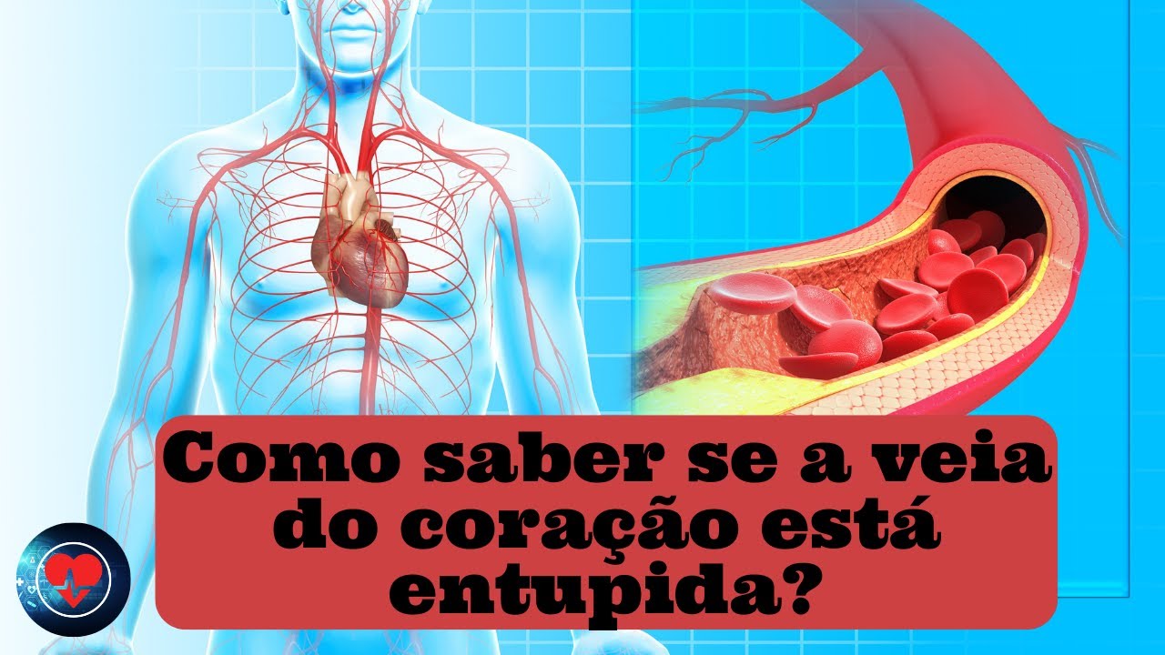 Veia do coração entupida Veja como saber! #veias #circulação #coração