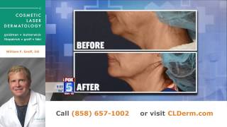 Fix Injectable Bruising, Poison Oak, ThermiTight, Alopecia Areata, Lasers for Acne Scars