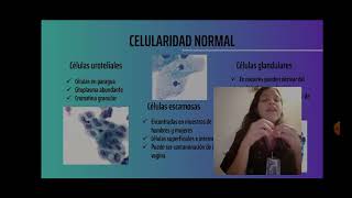 Citología Urinaria