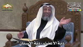 2357 - ديّة الأعضاء - ديّة الأسنان - عثمان الخميس