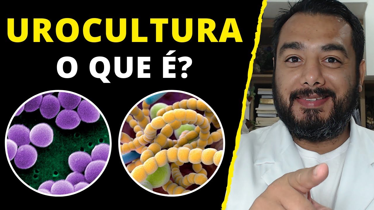 Assista Valor Do Exame Urocultura agora Valor Do Exame Urocultura