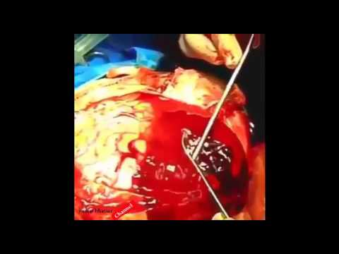 Potensi stimulan tanpa efek samping Pada pria dengan masalah potensi yang dokter