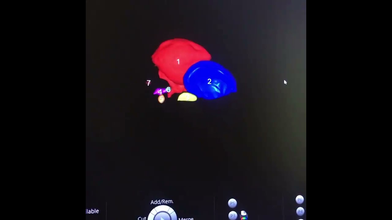 Kadriye Beril Yüksel-5