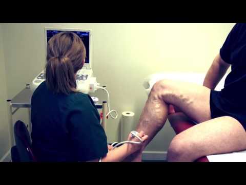 How to Scan the Perforator Veins Episode 4