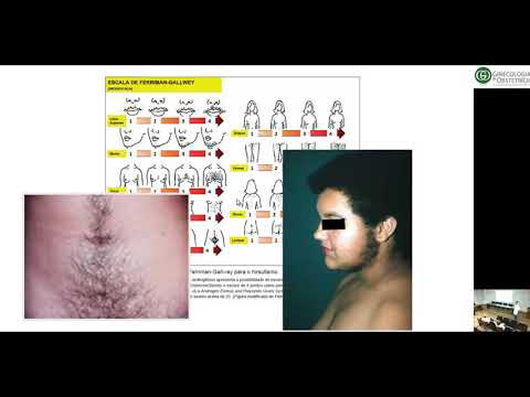 SOP - Consenso Atual