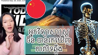 អ្នកវិទ្យាសាស្ត្រចិន បានរកឃើញ កាវបិទឆ្អឹង - World news 2025