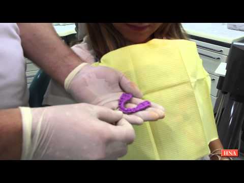 Knirscherschiene gegen Zähneknirschen im Schlaf