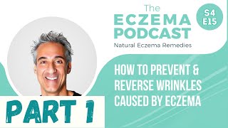 Top strategies to prevent and reverse wrinkles caused by eczema - Part 1 (S4E15)