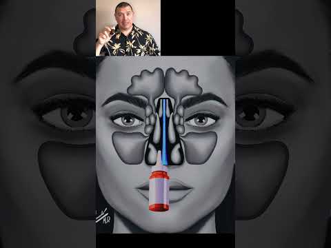 Nasal Spray Mistakes #shorts