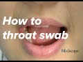 How to perform a throat swab on a patient