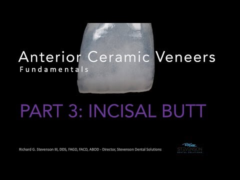 Anterior Ceramic Veneers, Part 3: Incisal Butt Veneer
