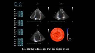 LVivo Seamless Testimonial by Steven Feinstein, M.D