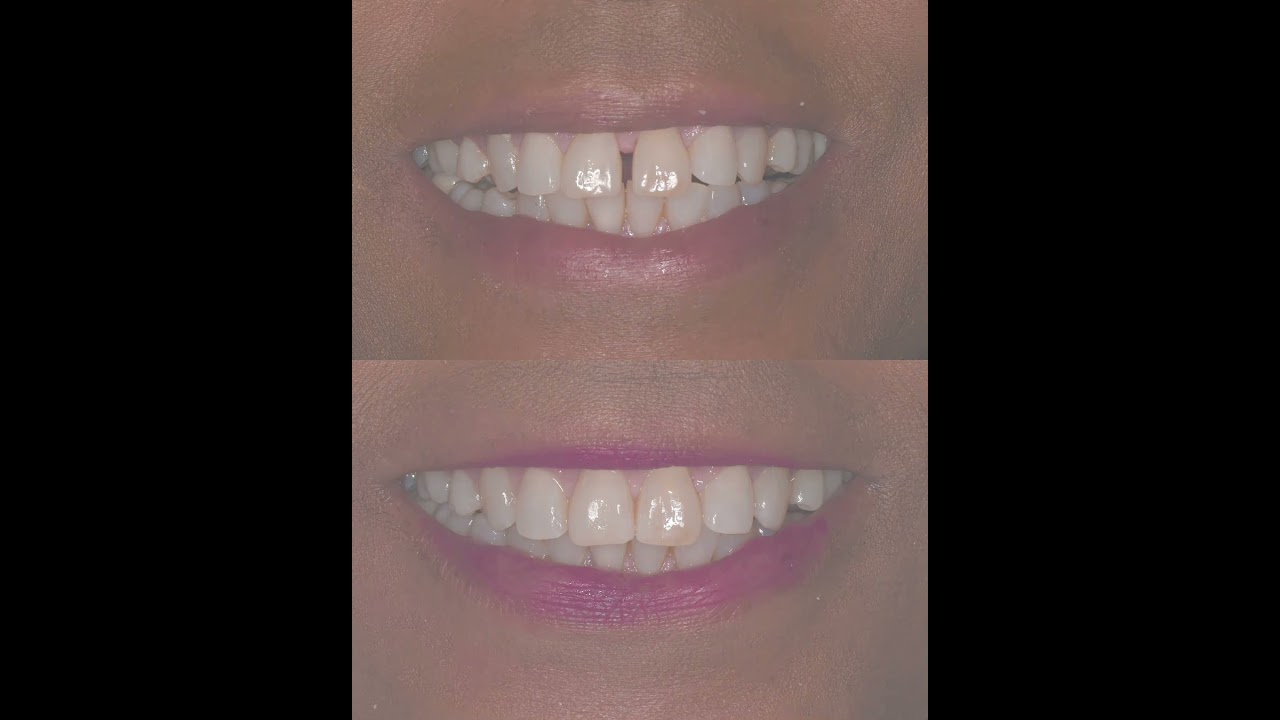 Smile Gallery Video 1