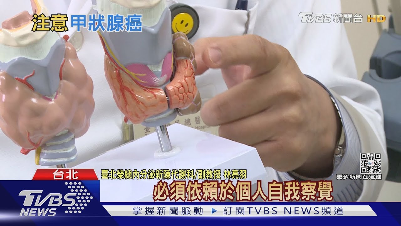 注意！　甲狀腺乳突癌好發「這族群」　醫師：確診後「終身追蹤」