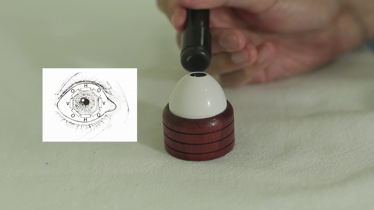 PEMERIKSAAN USG MATA