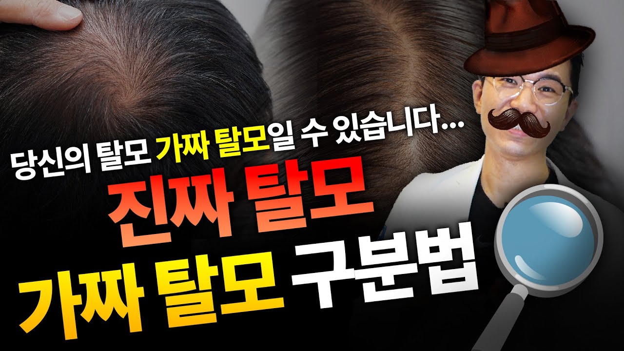  탈모 치료 전에 해야 하는 4가지