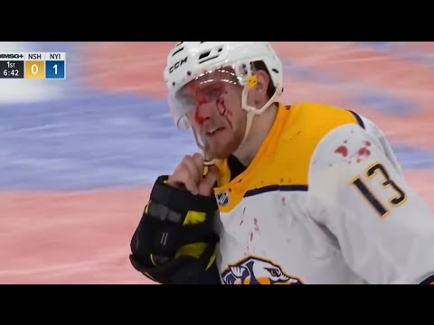 Zdeno Chara bloodies Yakov Trenin in one sided bout