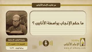 ما حكم الإنجاب بواسطة الأنابيب؟