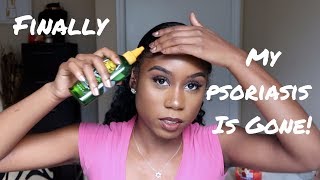 How I Calmed The Psoriasis Taking Over My Forehead With 1 Thing You Can Find In Your Kitchen!